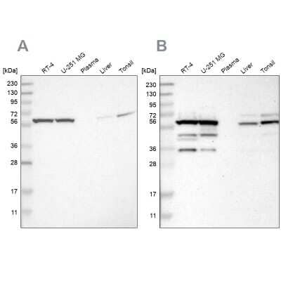 Western Blot: CCT8 Antibody [NBP1-88286]