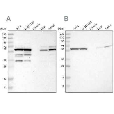 Western Blot: CCT8 Antibody [NBP1-88287]