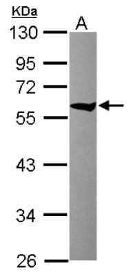 Western Blot: CCT8 Antibody [NBP2-15770]