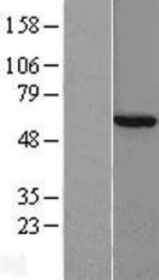 Western Blot: CCT8 Overexpression Lysate [NBL1-08903]