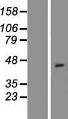 Western Blot: XCR1/CCXCR1 Overexpression Lysate [NBP2-11228]