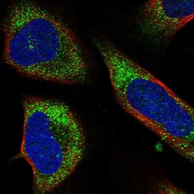 Immunocytochemistry/ Immunofluorescence: CCZ1 Antibody [NBP2-46711]