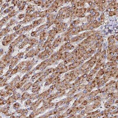 Immunohistochemistry-Paraffin: CCZ1 Antibody [NBP2-46711]