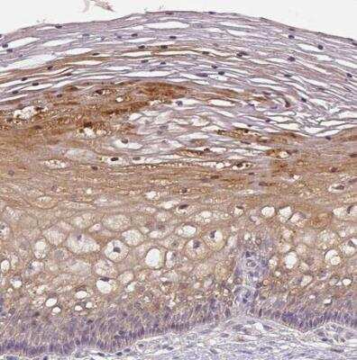 Immunohistochemistry-Paraffin: CCZ1 Antibody [NBP2-46780]