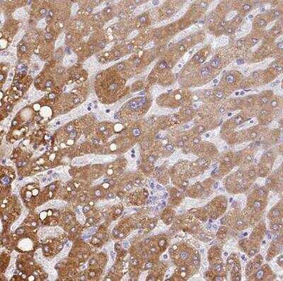 Immunohistochemistry-Paraffin: CCZ1 Antibody [NBP2-46780]