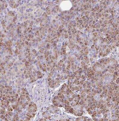 Immunohistochemistry-Paraffin: CCZ1 Antibody [NBP2-46780]