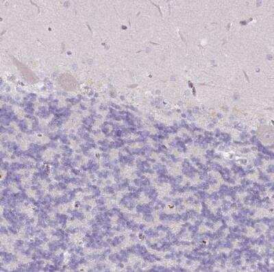 Immunohistochemistry-Paraffin: CCZ1 Antibody [NBP2-46780]