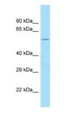 Western Blot: CCZ1 Antibody [NBP1-98558]