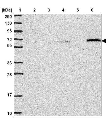 Western Blot: CCZ1 Antibody [NBP2-46780]