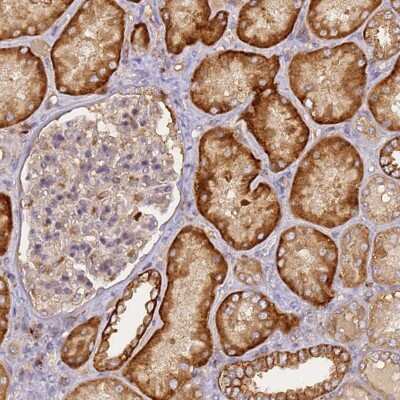 Immunohistochemistry-Paraffin: CD-M6PR Antibody [NBP2-38467]