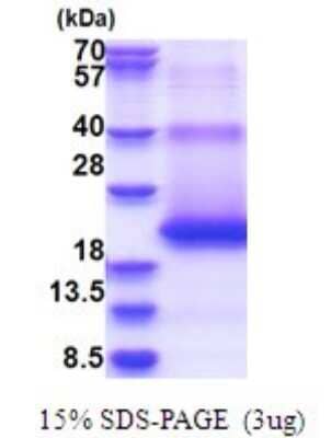 SDS-PAGE: Recombinant Human CD-M6PR His Protein [NBP2-51688]