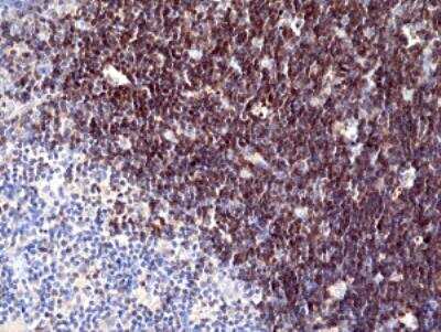 Immunohistochemistry-Paraffin: CD1 Antibody (RM393) [NBP2-89087]