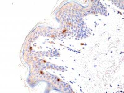 Immunohistochemistry-Paraffin: CD1 Antibody (RM393) [NBP2-89087]