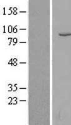 Western Blot: Neprilysin/CD10 Overexpression Lysate [NBL1-13148]