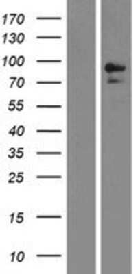 Western Blot: Neprilysin/CD10 Overexpression Lysate [NBP2-10369]