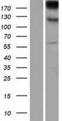 Western Blot: Integrin alpha E/CD103 Overexpression Lysate [NBP2-10814]