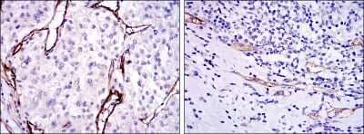 Immunohistochemistry-Paraffin: Endoglin/CD105 Antibody (3A9) - BSA Free [NBP2-22122]