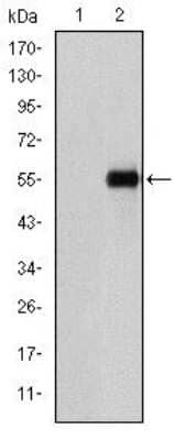 Western Blot: Endoglin/CD105 Antibody (3A9)BSA Free [NBP2-22122]
