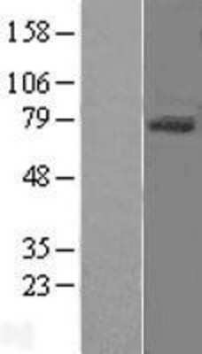 Western Blot: Endoglin/CD105 Overexpression Lysate [NBL1-10266]