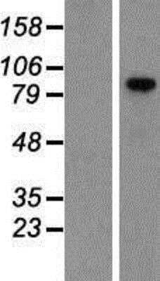 Western Blot: VCAM-1/CD106 Overexpression Lysate [NBP2-08467]