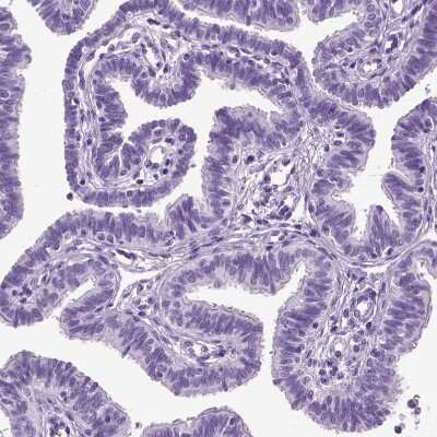 Immunohistochemistry-Paraffin: CD109 Antibody [NBP2-62598]