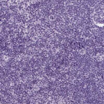 Immunohistochemistry-Paraffin: CD109 Antibody [NBP2-62598]
