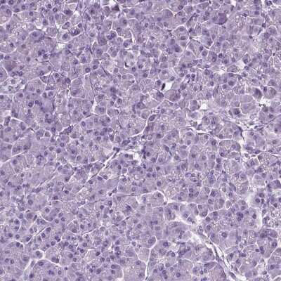 Immunohistochemistry-Paraffin: CD109 Antibody [NBP2-62598]