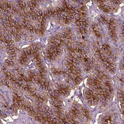 Immunohistochemistry-Paraffin: CD109 Antibody [NBP2-62598]