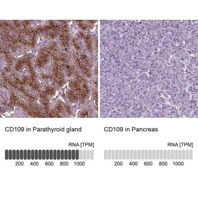 Immunohistochemistry-Paraffin: CD109 Antibody [NBP2-62598]