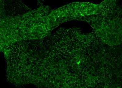 Immunocytochemistry/ Immunofluorescence: CD117/c-kit Antibody (007) [NBP2-89411]