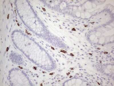 Immunohistochemistry: CD117/c-kit Antibody (OTI2B12) [NBP2-45508]