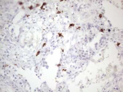 Immunohistochemistry: CD117/c-kit Antibody (OTI2B12) [NBP2-45508]