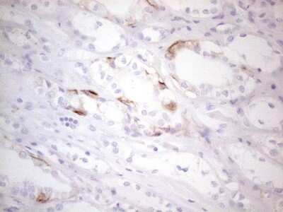 Immunohistochemistry: CD117/c-kit Antibody (OTI2B12) [NBP2-45508]