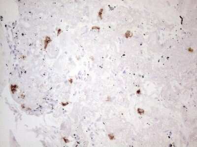 Immunohistochemistry: CD117/c-kit Antibody (OTI2B12) [NBP2-45508]