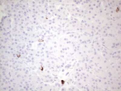Immunohistochemistry: CD117/c-kit Antibody (OTI2B12) [NBP2-45508]