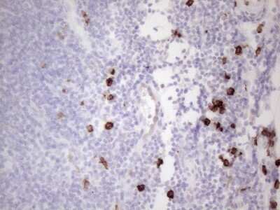 Immunohistochemistry: CD117/c-kit Antibody (OTI2B12) [NBP2-45508]