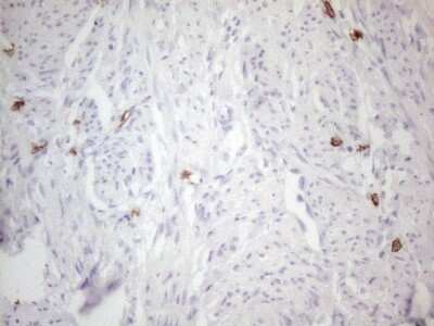Immunohistochemistry: CD117/c-kit Antibody (OTI2B12) [NBP2-45508]