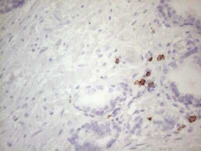 Immunohistochemistry: CD117/c-kit Antibody (OTI2B12) [NBP2-45508]