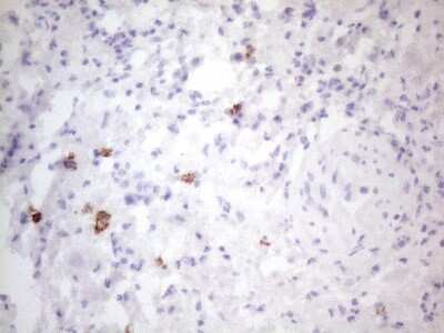 Immunohistochemistry: CD117/c-kit Antibody (OTI2B12) [NBP2-45508]