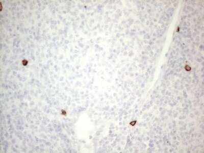 Immunohistochemistry: CD117/c-kit Antibody (OTI2B12) [NBP2-45508]