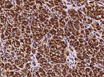 Immunohistochemistry-Paraffin: CD117/c-kit Antibody (351) [NBP2-90037]