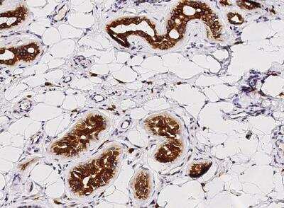Immunohistochemistry-Paraffin: CD117/c-kit Antibody (351) [NBP2-90037]