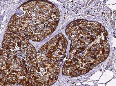 Immunohistochemistry-Paraffin: CD117/c-kit Antibody (351) [NBP2-90037]