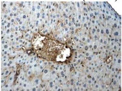 Immunohistochemistry: CD117/c-kit Antibody (9D2) - Azide and BSA Free [NB110-93600]