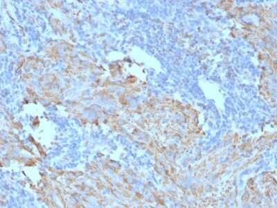 Immunohistochemistry-Paraffin: CD117/c-kit Antibody (C117/370) - Azide and BSA Free [NBP2-33192]