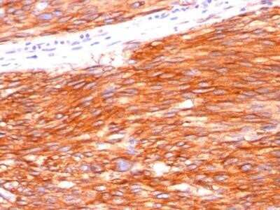 Immunohistochemistry-Paraffin: CD117/c-kit Antibody (C117/370) - Azide and BSA Free [NBP2-33192]