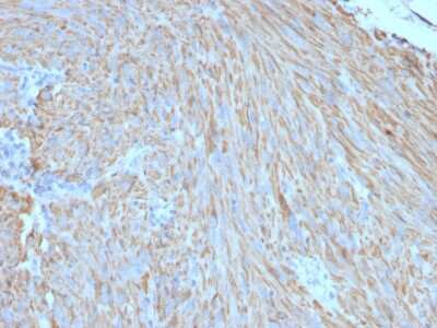 Immunohistochemistry-Paraffin: CD117/c-kit Antibody (C117/370) - Azide and BSA Free [NBP2-33192]