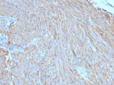 Immunohistochemistry-Paraffin: CD117/c-kit Antibody (C117/370) [NBP2-29423]