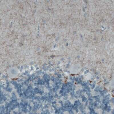 Immunohistochemistry-Paraffin: CD117/c-kit Antibody (CL1657) [NBP2-52975]