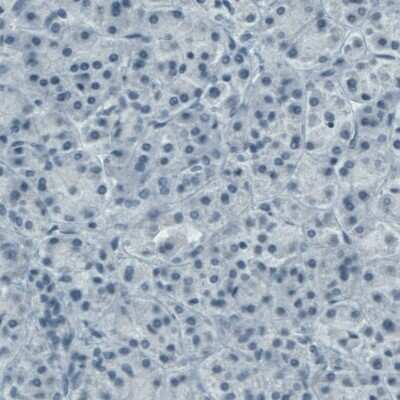 Immunohistochemistry-Paraffin: CD117/c-kit Antibody (CL1657) [NBP2-52975]